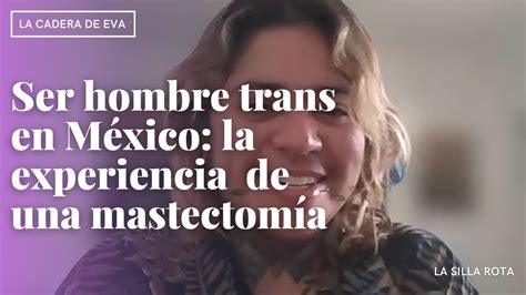 trans en guadalajara|MASTECTOMÍA GUADALAJARA, JALISCO